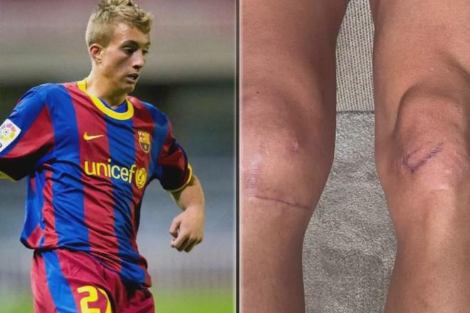 巴萨球员受伤,困扰逐渐加重 巴萨球员受伤,困扰逐渐加重